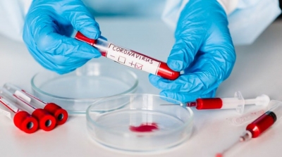 Bilan-Coronavirus :562 nouvelles contaminations et 25 décès