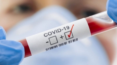 تونس: تسجيل 70 حالة وفاة و740 إصابة جديدة بكورونا