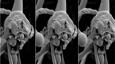 5 إصابات بالفطر الأسود في تونس