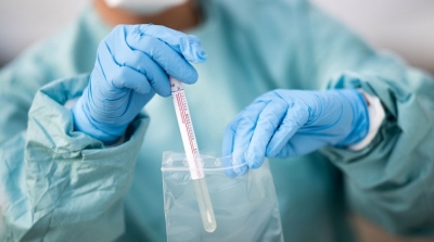 قائمة المعتمديات ذات انتشار مرتفع لعدوى كورونا