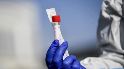 مختص في علم الفيروسات : نسبة الإصابة بكورونا بين الملقحين قد تصل 15 %