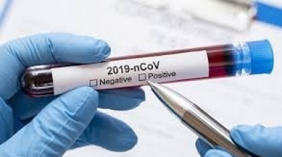 تونس : تسجيل 8 وفيات و 797 إصابة جديدة بكورونا 