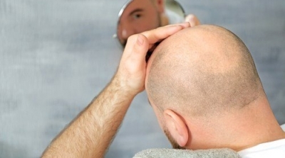 سعودية تطلب الطلاق بعد يومين من زفافها لأن زوجها أصلع !