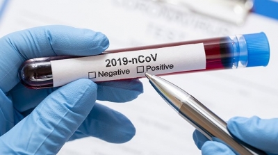Tunisie-Covid-19 : 489 contaminations et 05 décès 