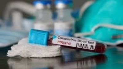 تونس تسجل 13 وفاة بكورونا وتراجع نسبة التحاليل الإيجابية