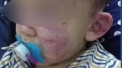 رضيع يتعرض للعنف الشديد في أول يوم له في الروضة (صور)