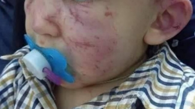 اعتداء على رضيع : الاحتفاظ بصاحبة الروضة في القيروان